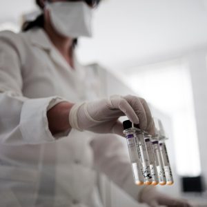 50 testů na tuberkulózu